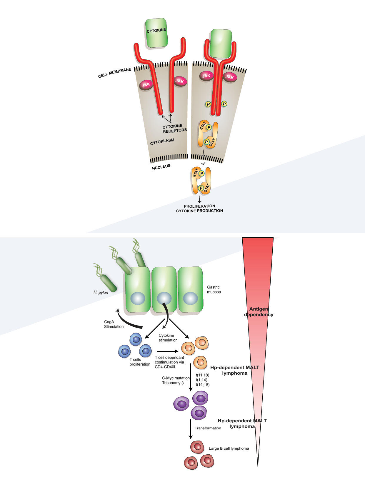 lymphoma